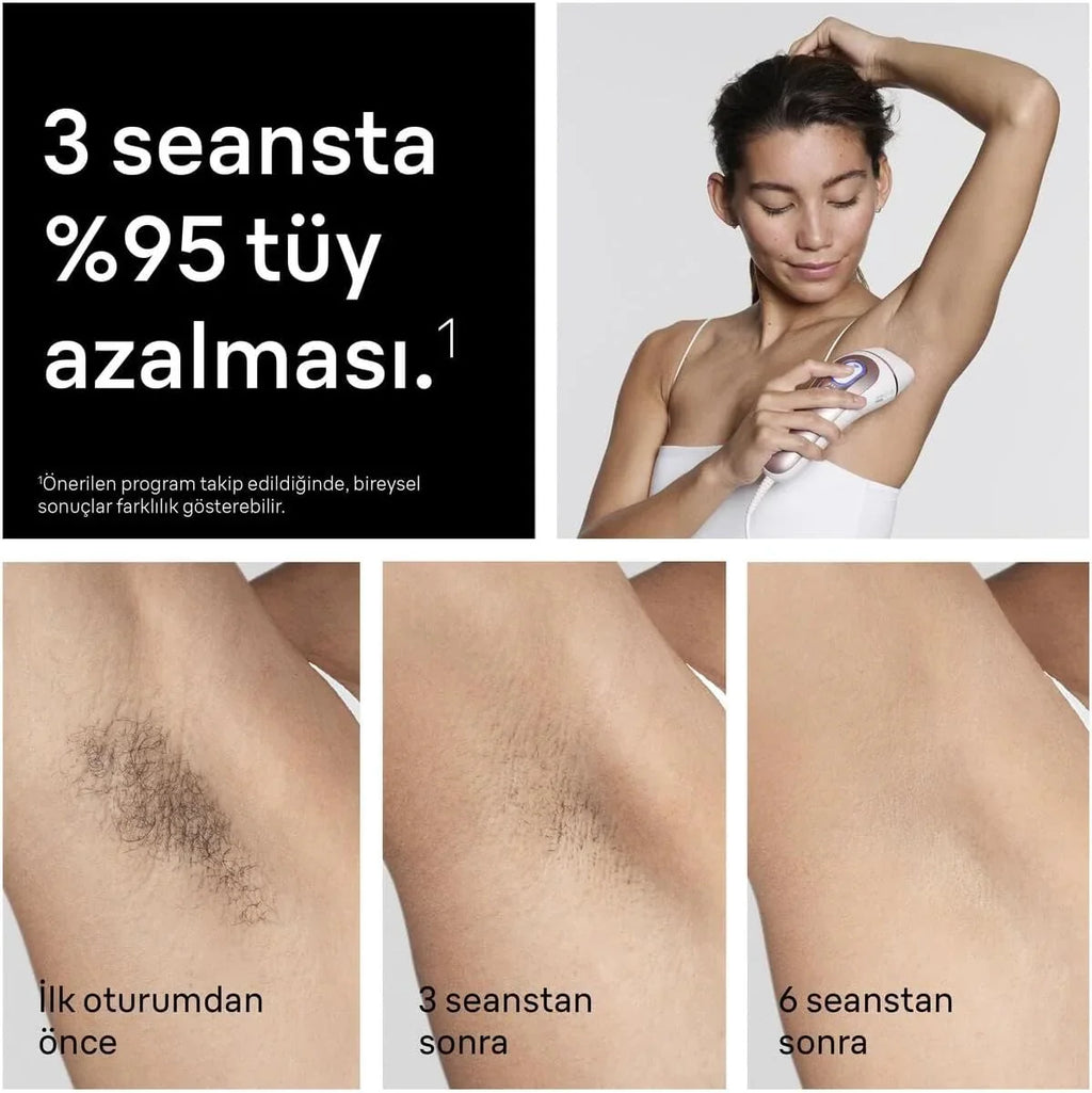 Braun Lumiere Pulsee Intelligent Skin i·expert PL7431, biały i brązowy - domowa alternatywa dla lasera, przewodowa, z kieszenią, brzytwą Gillette Venus, 4 głowice, podłączony do aplikacji